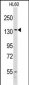 VARS Antibody (Center)